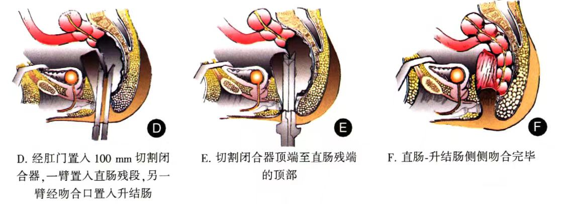 17192808794145.png 17192808794145.png